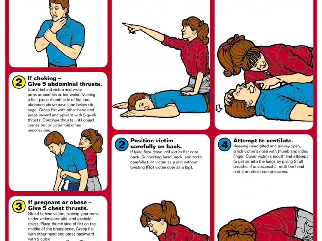 Cpr перевод. Choking определение. Signs of choking. Lora Cross CPR.